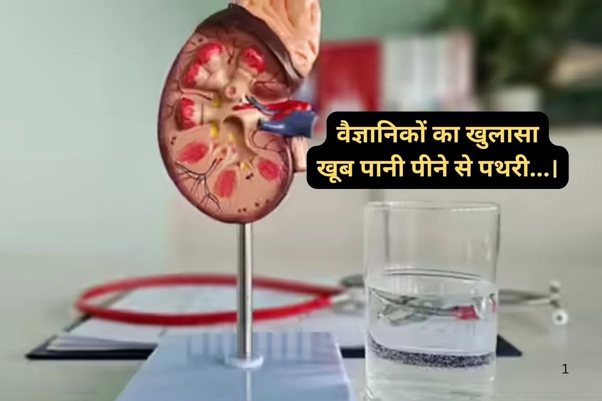 Kidney Health : “खूब पानी पियो” पथरी ना होने के लिए दी जाने वाली सलाह गलत! किडनी पर हुए नए शोध में खुलासा