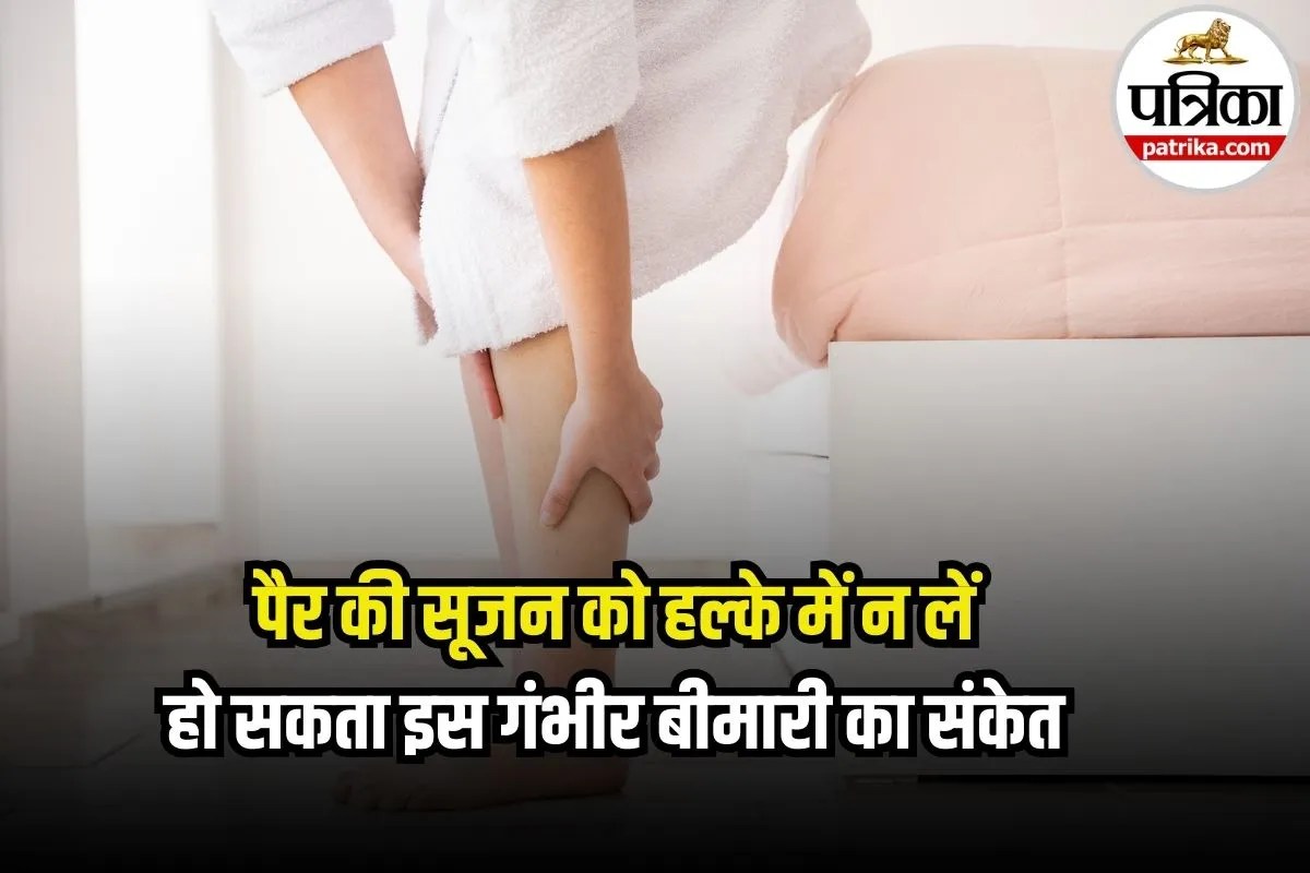 Leg Swelling & Pain Warning: बार-बार पैर दर्द को न करें नजरअंदाज, बन सकती है गंभीर बीमारी