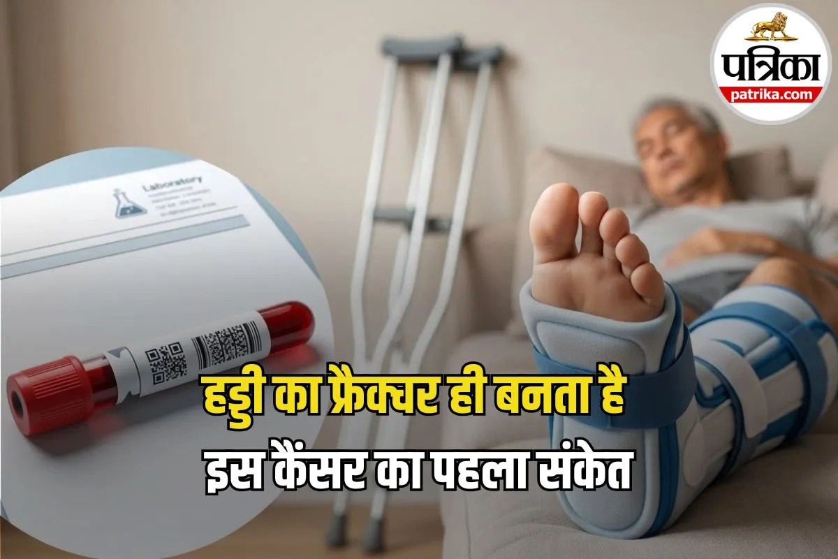 Multiple Myeloma Symptoms: बिना चोट के टूटी हड्डी? सावधान! यह सामान्य फ्रैक्चर नहीं, हो सकता है कैंसर का शुरुआती संकेत