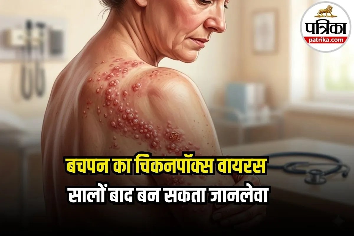Shingles Symptoms: डायबिटीज और किडनी के मरीजों को दाद का ज्यादा जोखिम, भूलकर भी न करें इन लक्षणों को नजरअंदाज