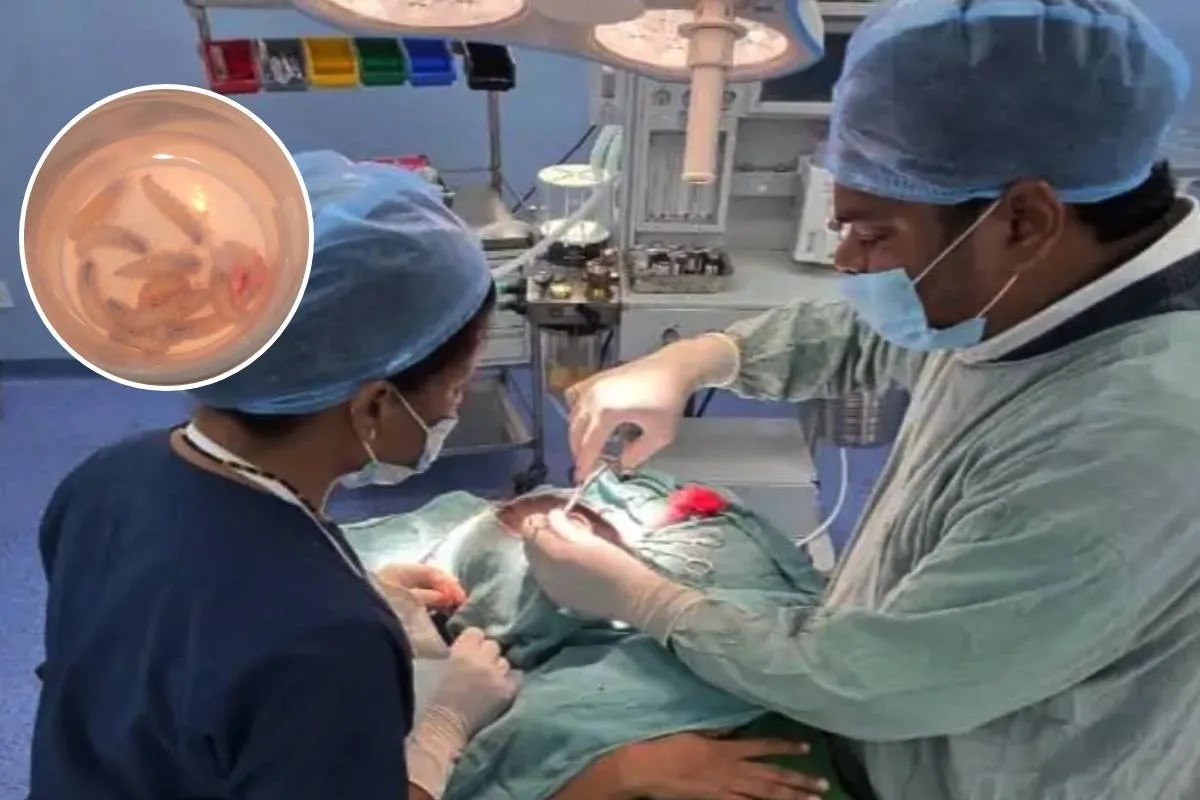 बच्ची की नाक में कीड़े पड़ गए थे, एंडोस्कोपिक तकनीक से ऑपरेशन कर बचाई जान