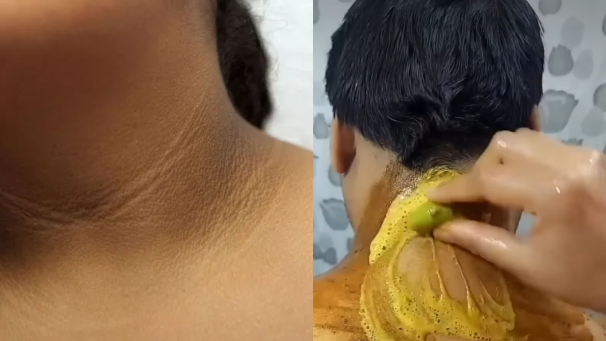 काली गर्दन को साफ करने के उपाय, दूर हो जाएगी टैनिंग और गंदगी, इस्तेमाल करें ये घरेलू नुस्खा