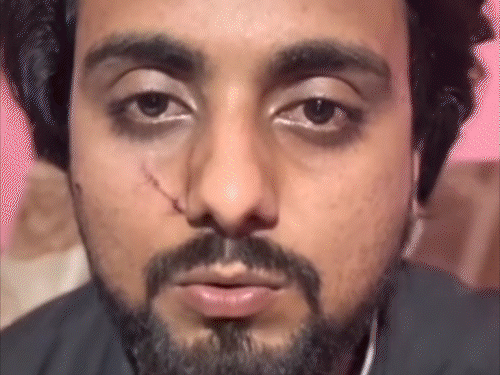 ‘भाभी को गौ-मांस खिलाओ, मुस्लिम बनाओ’:हिंदू बहू पर ससुराल वालों का टॉर्चर; पति ने शेयर किया बहन का ऑडियो, बोली- काफिर को हमपर मत थोपो