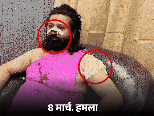 आशुतोष महाराज ने पूछा- मेरा मेडिकल 6 दिन बाद क्यों:चलती ट्रेन में हमले की FIR 17 घंटे बाद हुई, अभी तक हमलावर नहीं पकड़ा गया