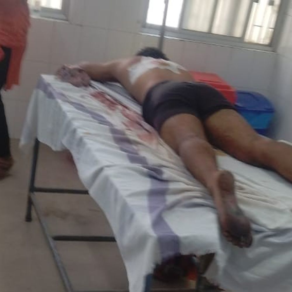 बक्सर में होली पर गोलीबारी:22 साल का युवक घायल, पुलिस ने स्थिति नियंत्रित कर गश्ती बढ़ाई, आरोपियों की गिरफ्तारी के प्रयास जारी