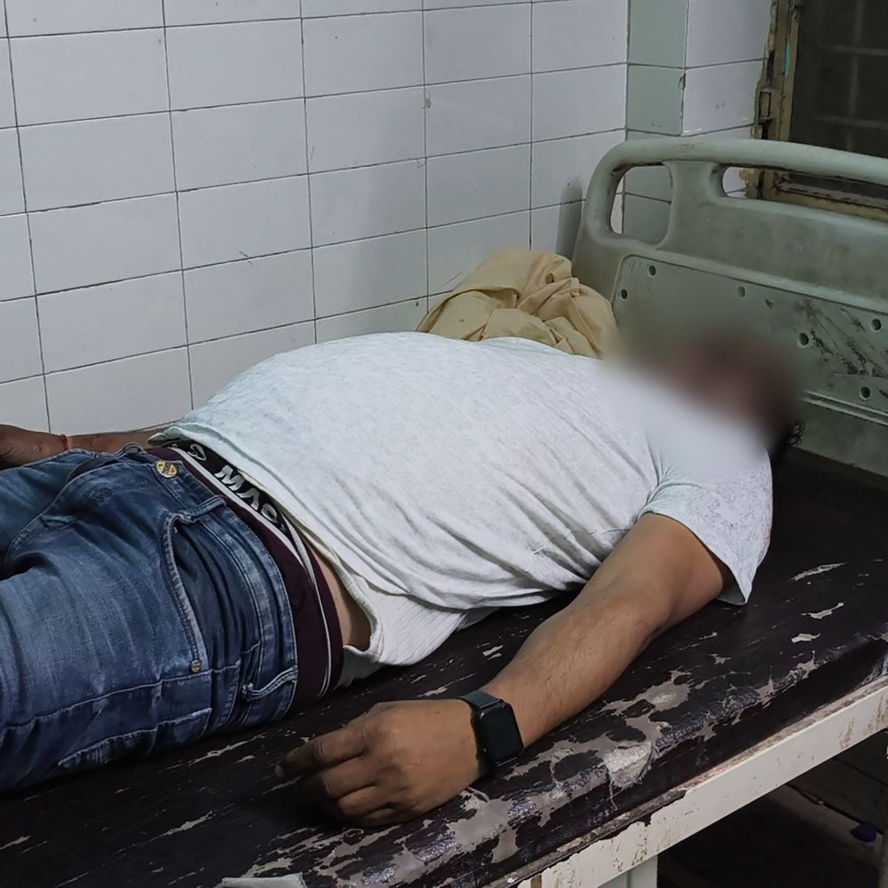 कैंटर ने बाइक सवार दंपति को रौंदा, पति की मौत:रिश्तेदारी में जा रहे थे, मैनपुरी में पत्नी की हलक नाजुक