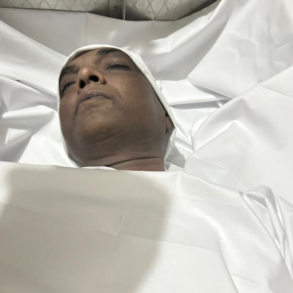 मुरादाबाद में बीएलओ ड्यूटी के दौरान टीचर का निधन:बेटी की शादी की तैयारियों के बीच परिवार में शोक