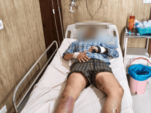 रेवाड़ी में युवक पर लाठी-डंडों से हमला, 10 मिनट पीटा:पैदल दोस्त के घर से आते समय वारदात, 7 को इंटरव्यू, पिता राजस्थान में इंस्पेक्टर