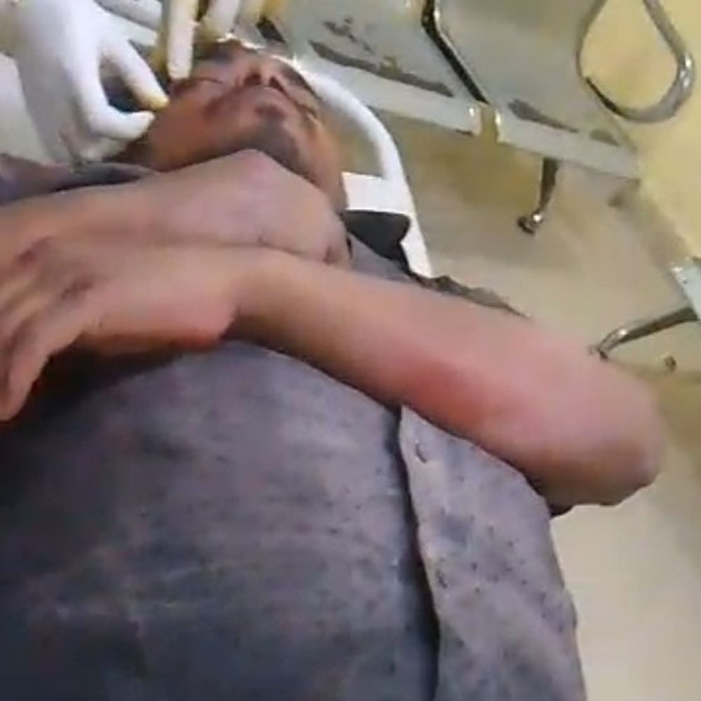 अज्ञात वाहन की टक्कर से बाइक सवार गंभीर घायल:भगवानपुर ओवरब्रिज पर जख्मी हाल में मिला, डायल 112 पुलिस ने अस्पताल पहुंचाया