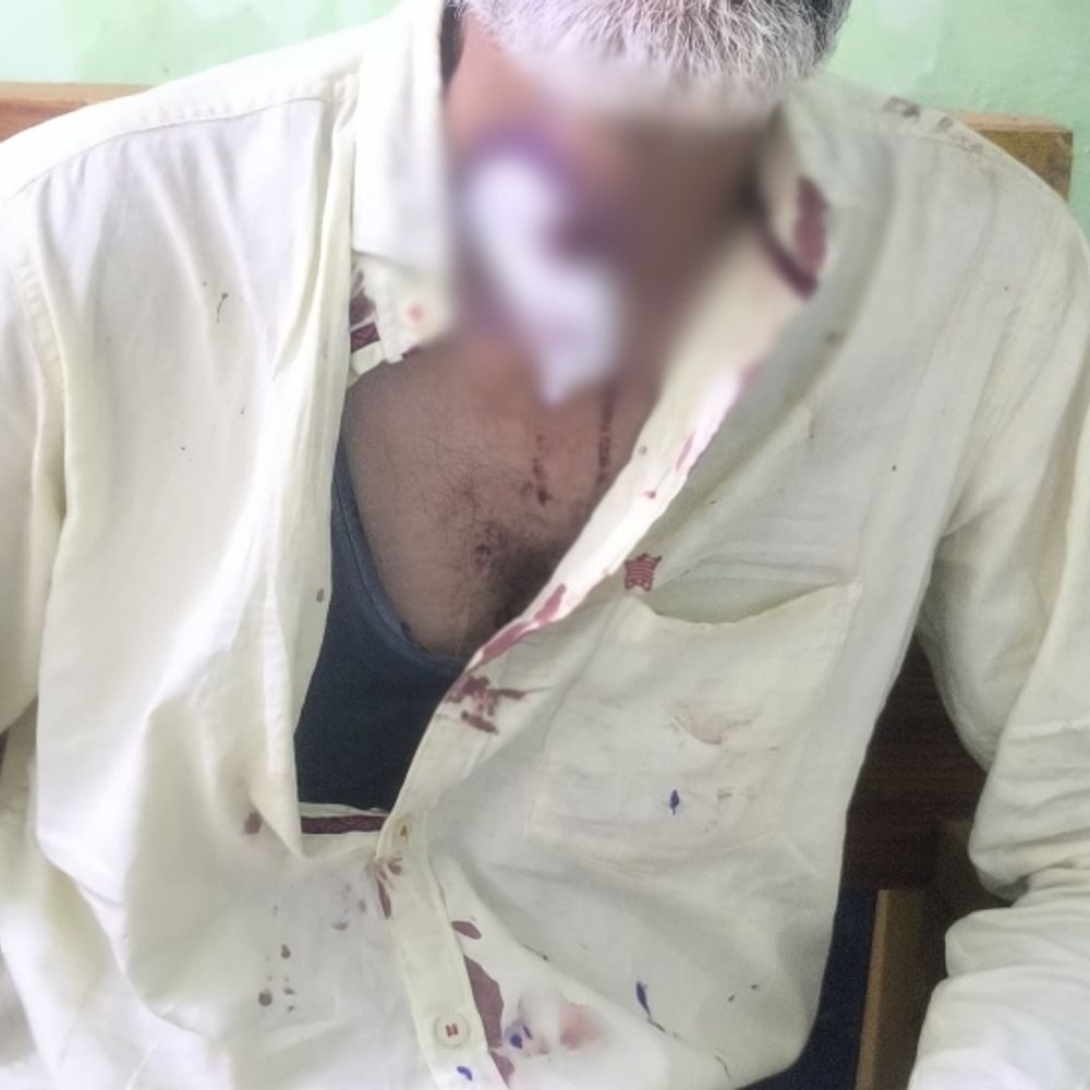 गाली देने से मना किया,पड़ोसी ने हंसिया से काटा गला:बलौदाबाजार में युवक गंभीर घायल, डॉक्टर ने चोट को बताया गंभीर