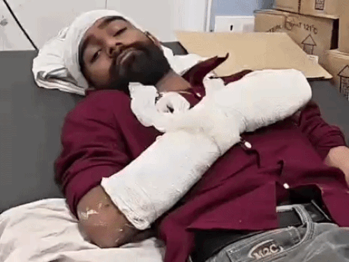 भीलवाड़ा में डीजे संचालक को किडनैप कर पीटा:हथियारबंद बदमाशों ने 2 घंटे मारपीट की, सड़क पर फेंककर भागे; कैश-ज्वेलरी लूटी