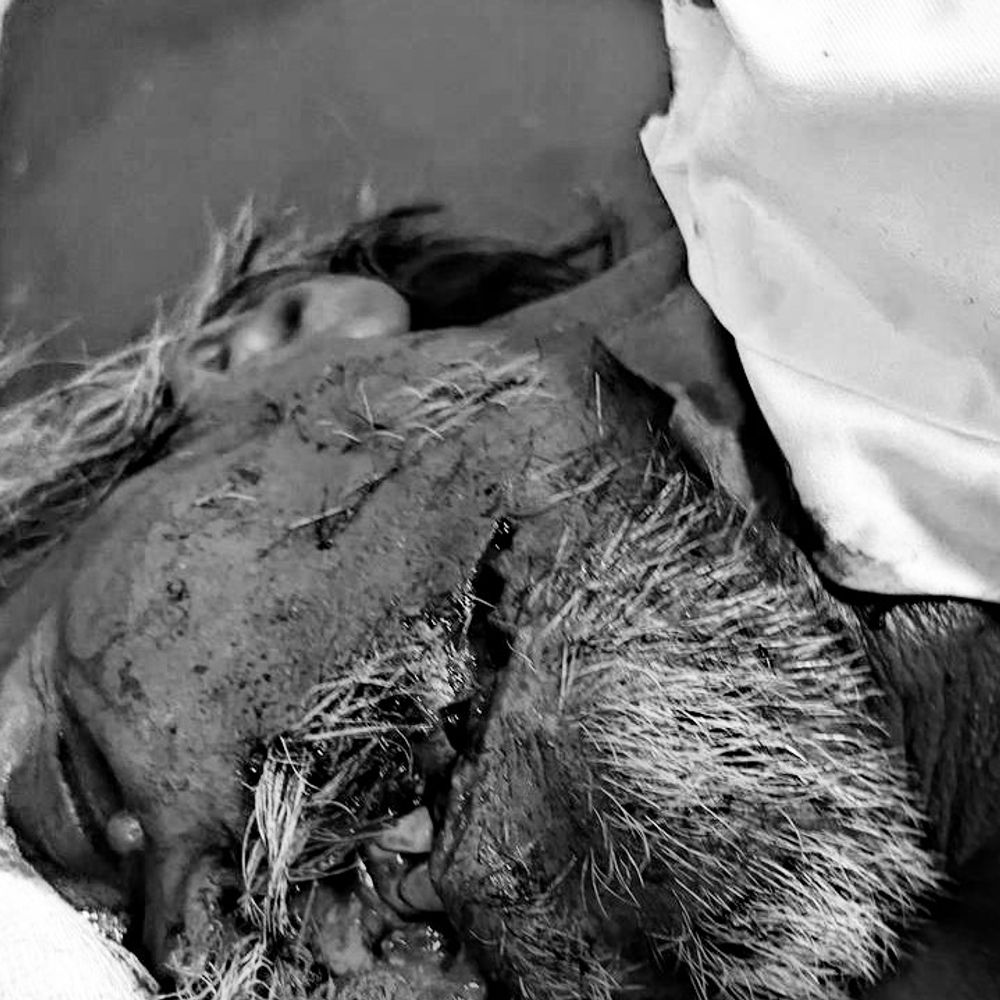 शराब के नशे में बेटे ने पिता का चेहरा काटा:विवाद के बाद फसल काटने वाले हथियार से किया वार; गंभीर हालत में ICU में भर्ती