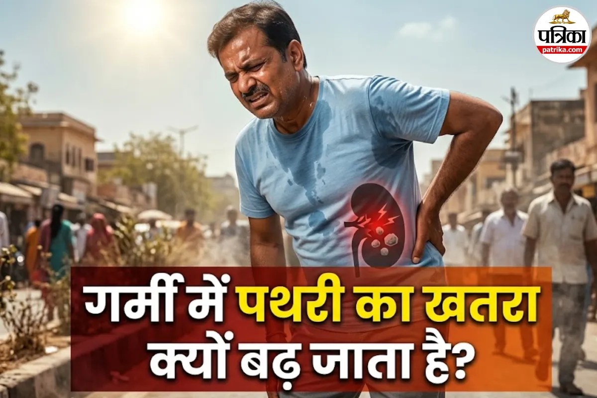 सावधान! गर्मी में प्यास को नजरअंदाज करना पड़ सकता है महंगा, बढ़ सकता है किडनी स्टोन का खतरा