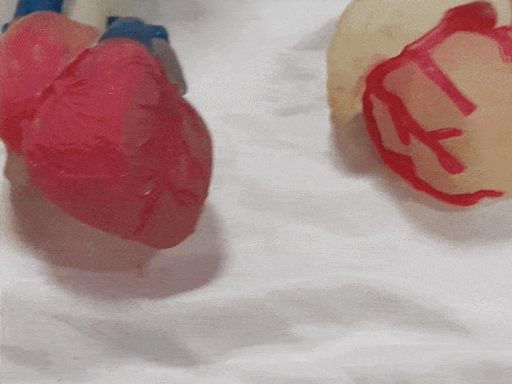 कागजी रिपोर्ट नहीं… दिल-किडनी के 3डी मॉडल बताएंगे बीमारी:डॉक्टर अंगों को हाथ में लेकर बनाएंगे इलाज की रणनीति, एम्स भोपाल और आईओसीएल के बीच एमओयू