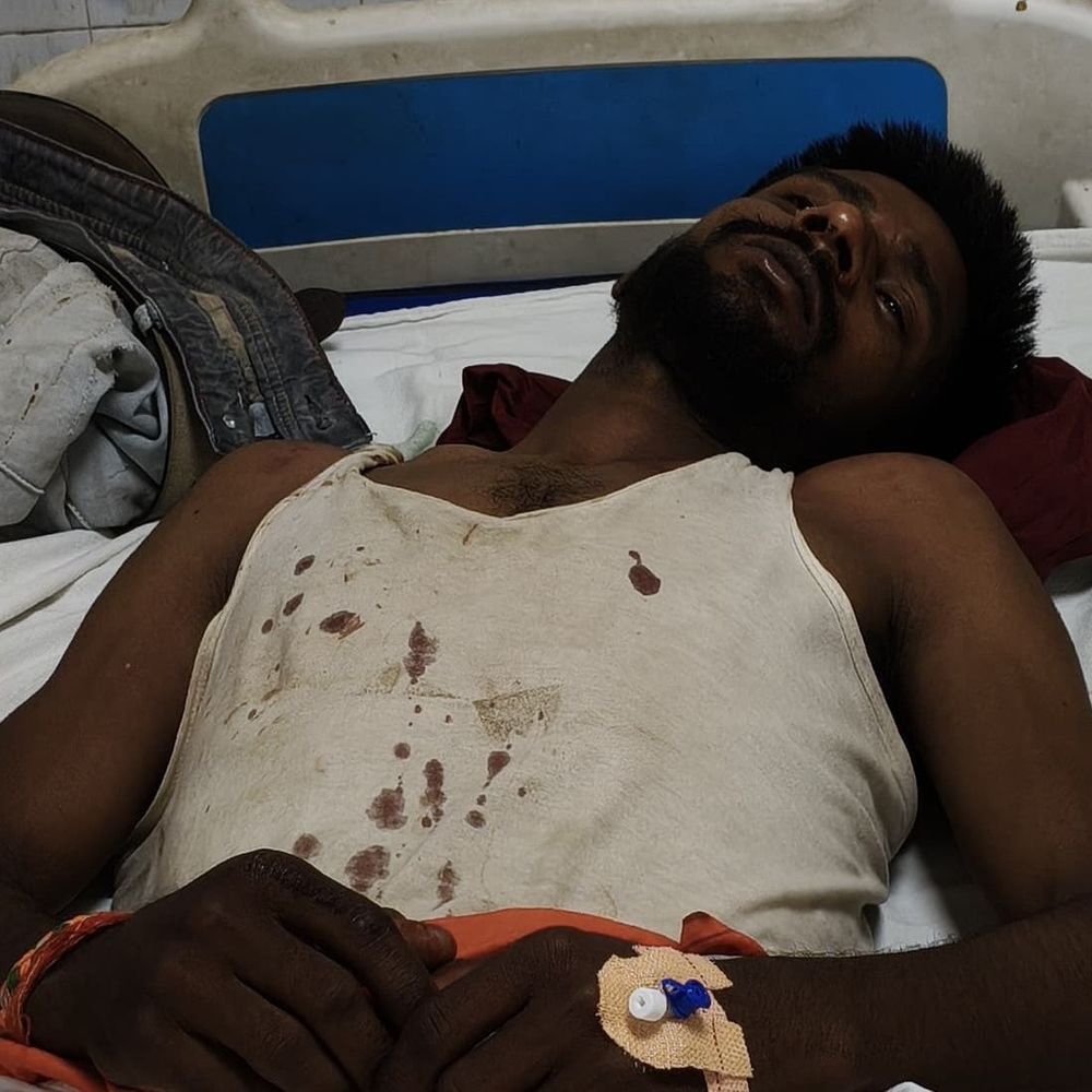 गयाजी में पत्रकार की पिटाई, बाइक लेकर भागे बदमाश:घायल बोला- सवाल पूछने पर ठेकेदार ने बदमाशों को बुलाकर पिटवाया