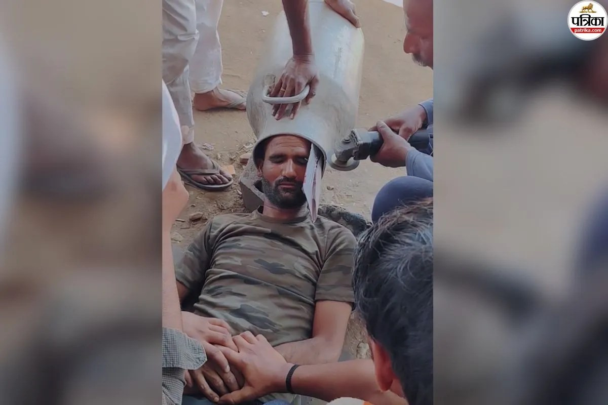युवक के सिर में फंसी 10 किलो वजनी दूध की कैन, ग्राइंडर से काटकर निकाली, धूप से बचने का जुगाड़ बना मुसीबत