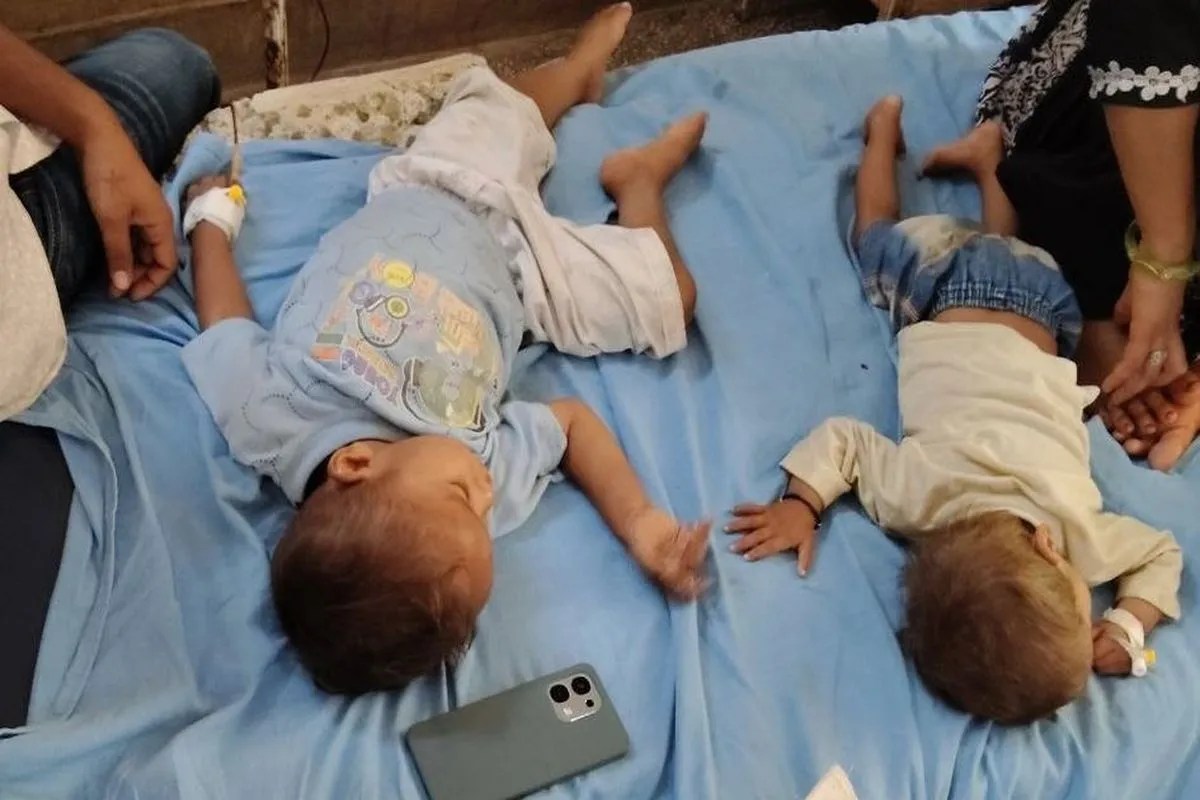 अलवर: शिशु चिकित्सालय में बदहाली की हद, एक बेड पर 2-3 तीन मासूम; 20 बेड का वार्ड दो साल से बंद