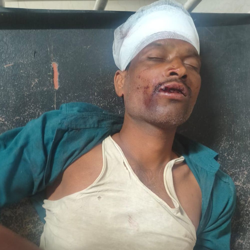 दो बाइक की टक्कर, तीन घायल:एक माइक्रो फाइनेंस कंपनी में काम करता, दो युवक सर्राठे मलाजखंड की ओर से बालाघाट आ रहे थे