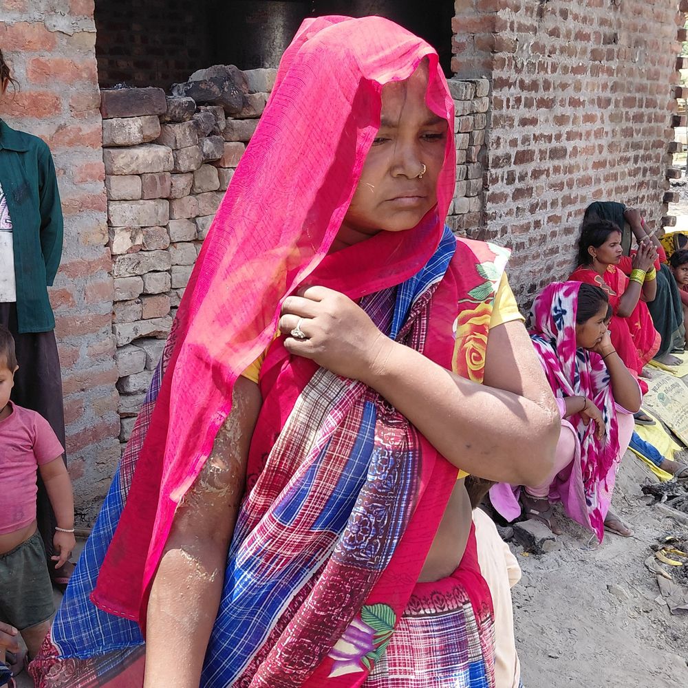 अग्निकांड के पीड़ितों के नहीं रुक रहे आंसू:गेहूं-आलू जले, बक्से में रखे जेवरात भी खाक; मदद की आस में ग्रामीण