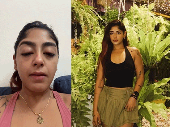 स्प्लिट्सविला कंटेस्टेंट का दांत टूटा, आंखों में सूजन आई:प्रीत सिंह ने मुंबई के क्लब में मारपीट होने का दावा किया