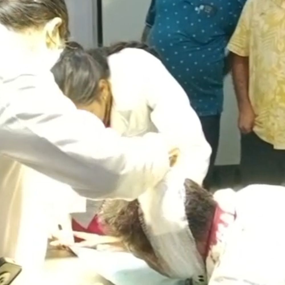 बाउंड्री विवाद में मारपीट, दंपति सहित 3 घायल:गंभीर हालत में पति-पत्नी रीवा रेफर; बहस के बाद मारपीट