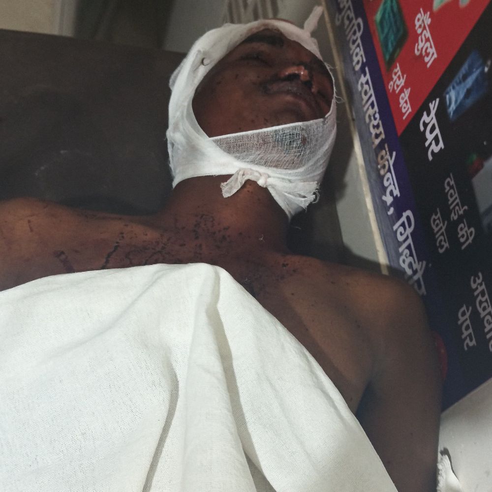 गिद्धौर में ट्रेन से गिरकर युवक गंभीर घायल:प्राथमिक उपचार के बाद जमुई सदर रेफर किया गया