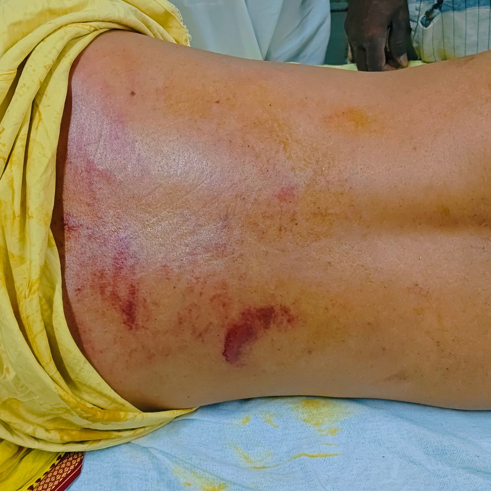 टहेटा स्टेशन पर युवक पर 10-15 बदमाशों का हमला:मखदुमपुर से घर लौटते समय घेरकर पीटा, गंभीर घायल