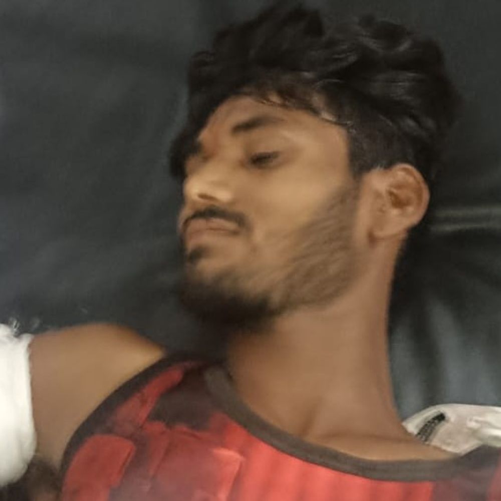 सीधी में बस-पिकअप में टक्कर, युवक का हाथ कटकर अलग:रीवा रेफर; चश्मदीद बोले- बस ड्राइवर नशे में था, वाहन छोड़कर भागा