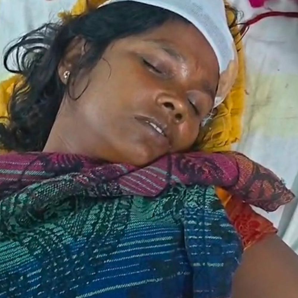 सिंघिया में मां-बेटी से मारपीट:आरोपियों ने पुरानी रंजिश में घर में घुसकर पीटा, घायल, पीएचसी में भर्ती