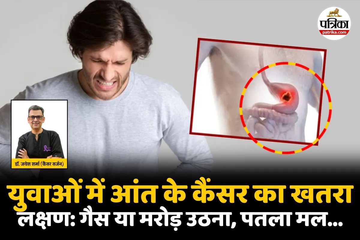 Aant Ka Cancer : युवाओं में आंत का कैंसर बढ़ रहा, वैज्ञानिक चिंतित! जानिए लक्षण और कारण