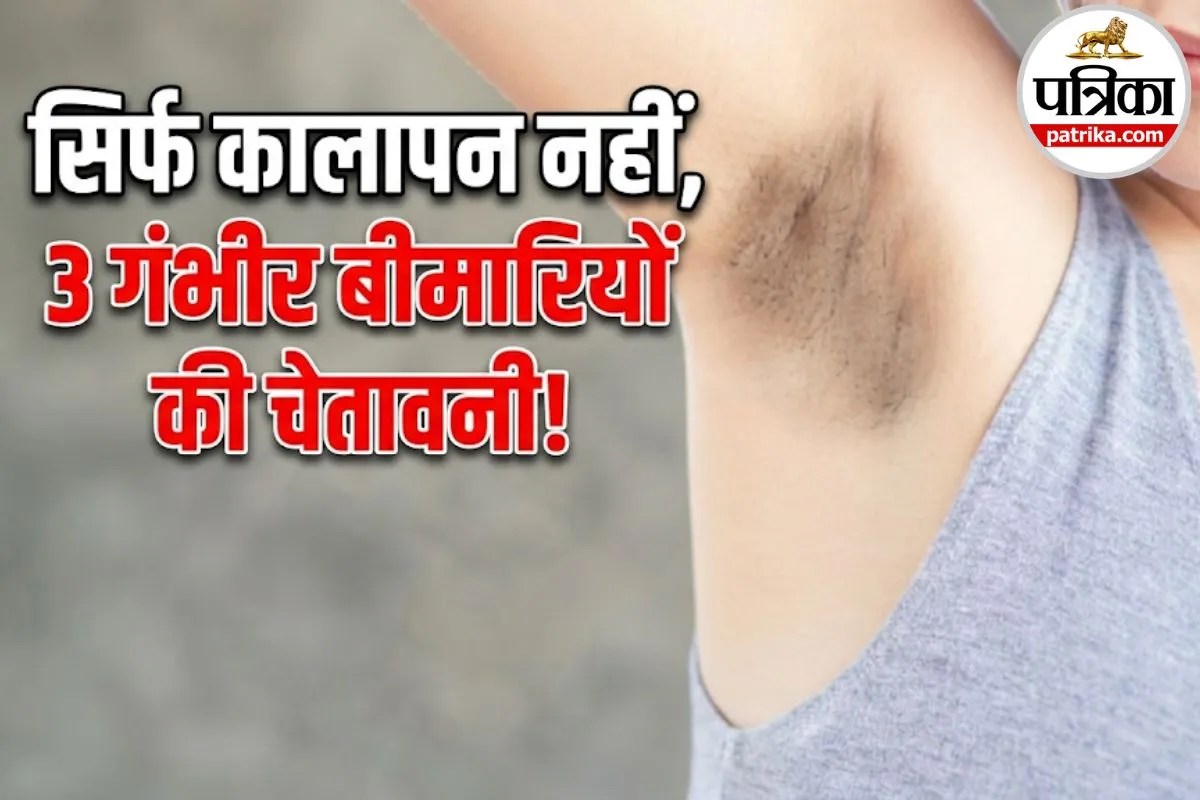 डार्क अंडरआर्म्स सिर्फ स्किन प्रॉब्लम नहीं, इन 3 गंभीर बीमारियों का है शुरुआती संकेत!