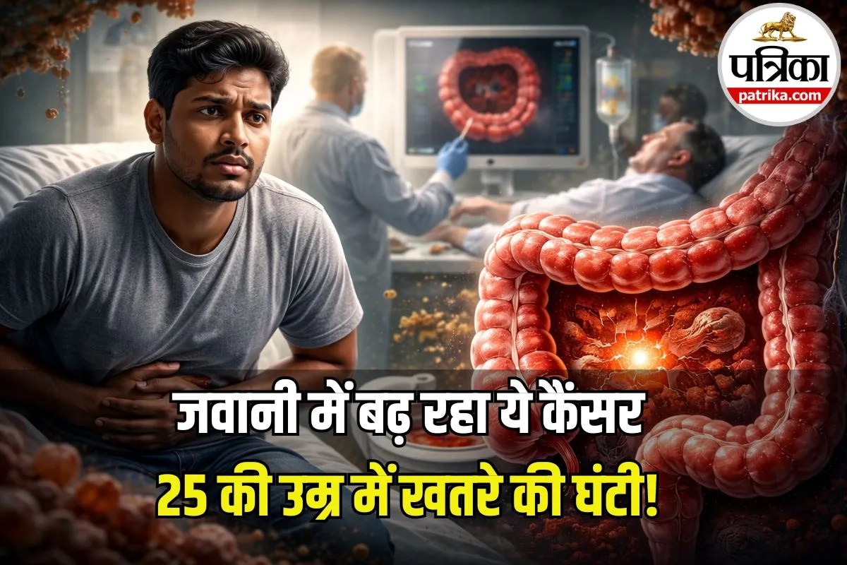 कम उम्र में बढ़ रहा Colon Cancer का खतरा! कम पढ़े-लिखे लोगों में ज्यादा मौतें, नई स्टडी में खुलासा