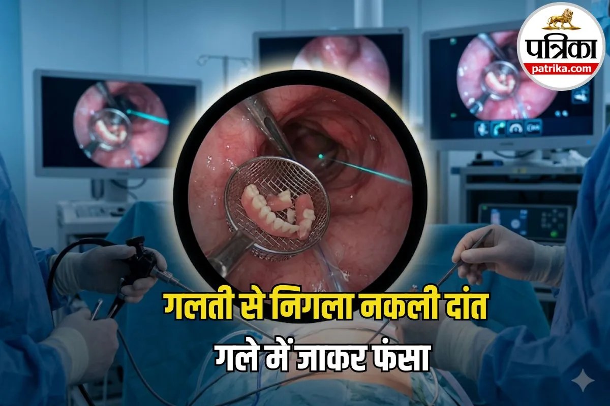 Denture Stuck in Throat: गले में फंसा नकली दांत, सांस तक रुक गई! डॉक्टरों ने ऐसे बचाई जान