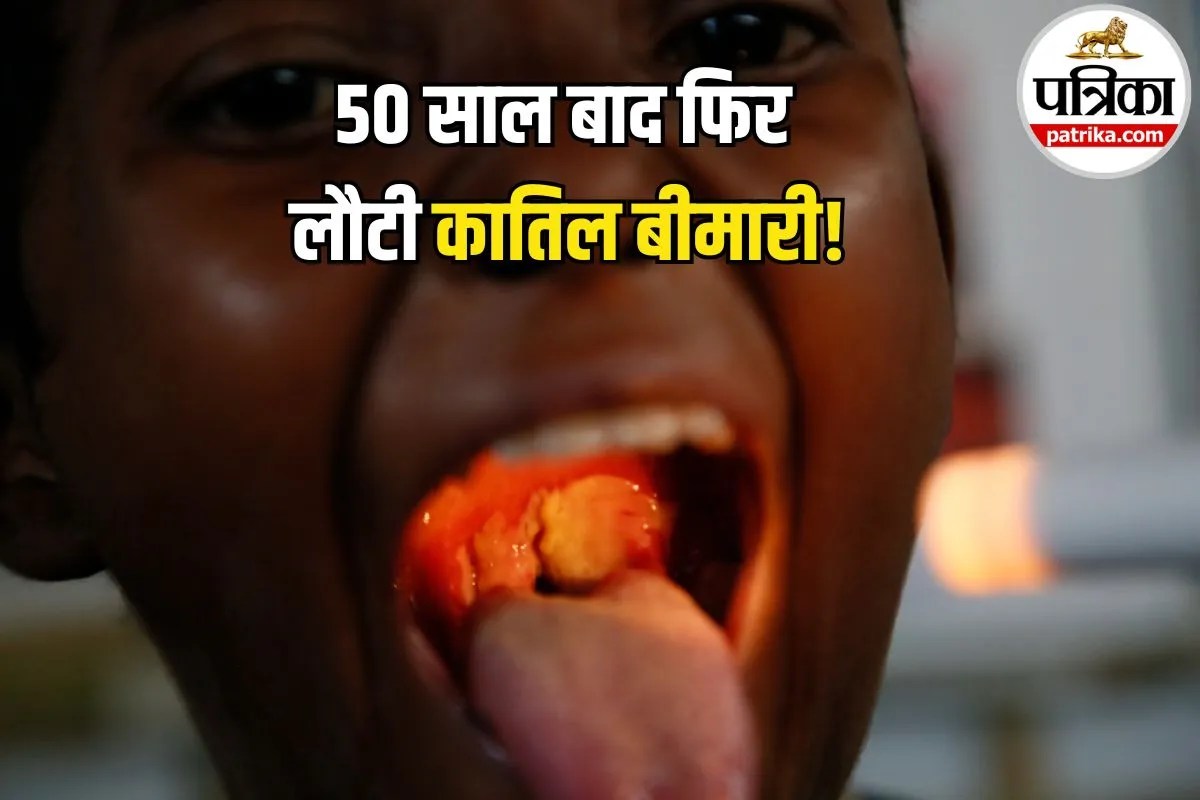 गले में खराश को न करें नजरअंदाज! 50 साल पुरानी खतरनाक बीमारी की वापसी, जानें लक्षण और बचाव