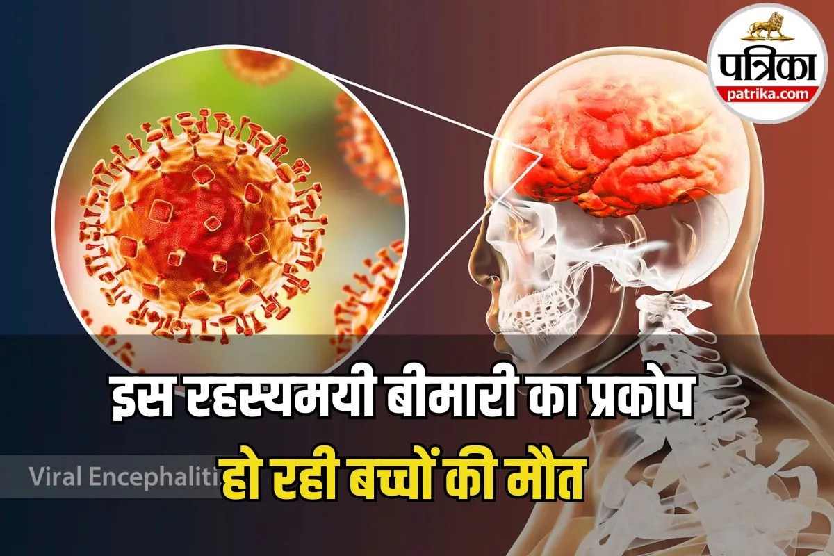 Encephalitis Symptoms: राजस्थान में रहस्यमयी बीमारी से 5 बच्चों की मौत, जानिए क्या है एन्सेफलाइटिस