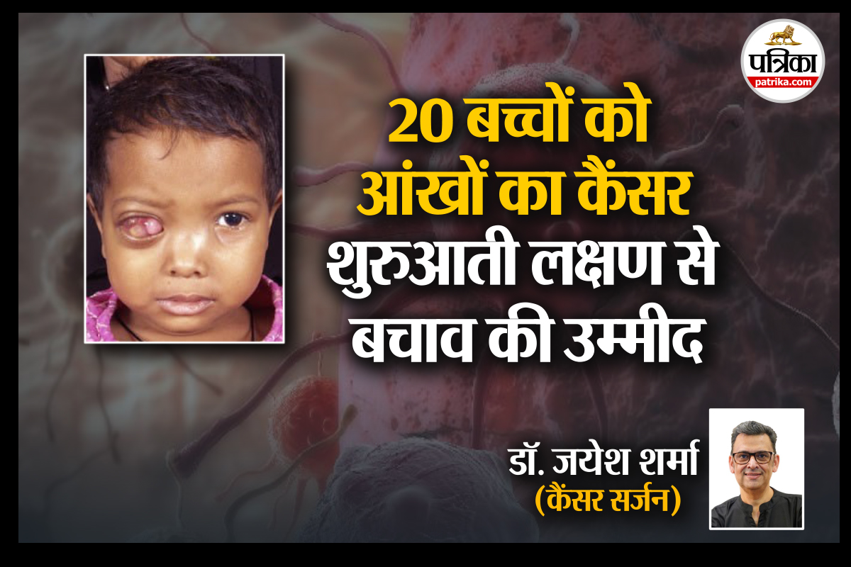 Eye Cancer in Children : यूपी-बिहार के 20 बच्चों के आंखों में कैंसर, निकालनी पड़ रही आंखें, कैंसर सर्जन से समझिए लक्षण