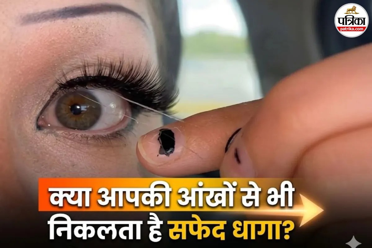 सावधान! आंखों से निकलने वाला सफेद धागा कोई कीचड़ नहीं, एक बीमारी है! जितना साफ करोगे, ये उतना बढ़ेगा, जानिए क्यों!