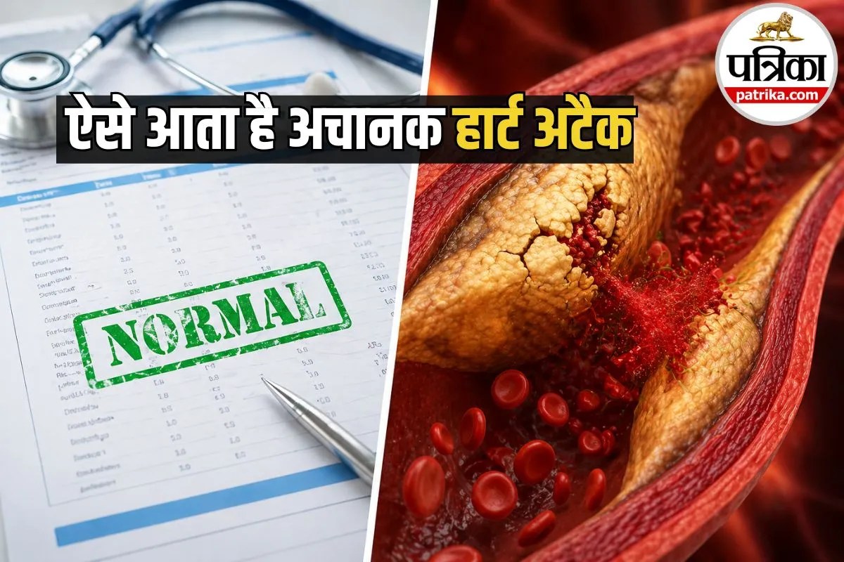 ‘नॉर्मल’ रिपोर्ट के बाद भी आ सकता है Heart attack? जानिए ऐसा क्यों कह रहे हैं डॉक्टर