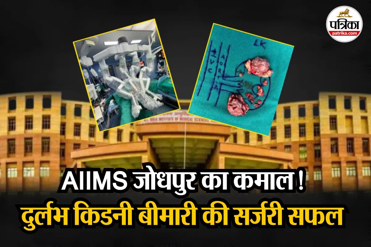 Kidney Tumors : एम्स जोधपुर ने रचा इतिहास, जटिल किडनी स्टोन की सर्जरी सफल, जानिए लक्षण और कारण