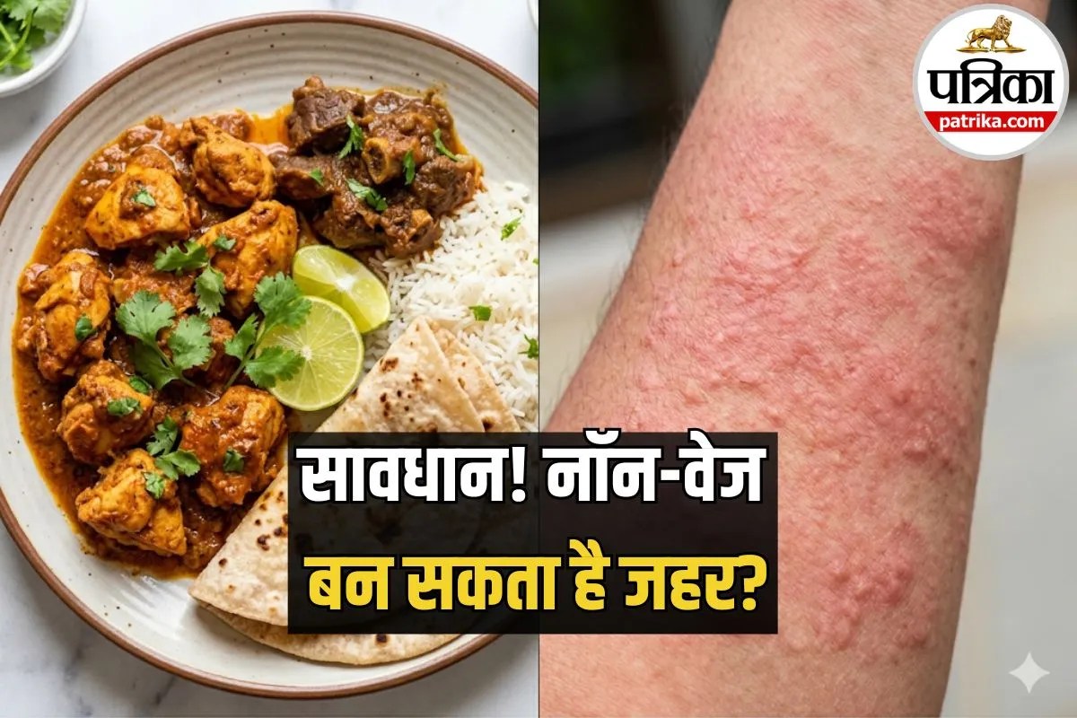 नॉन-वेज खाने वालों सावधान! कहीं आपका पसंदीदा खाना ही स्किन रैशेज और खुजली की वजह तो नहीं?