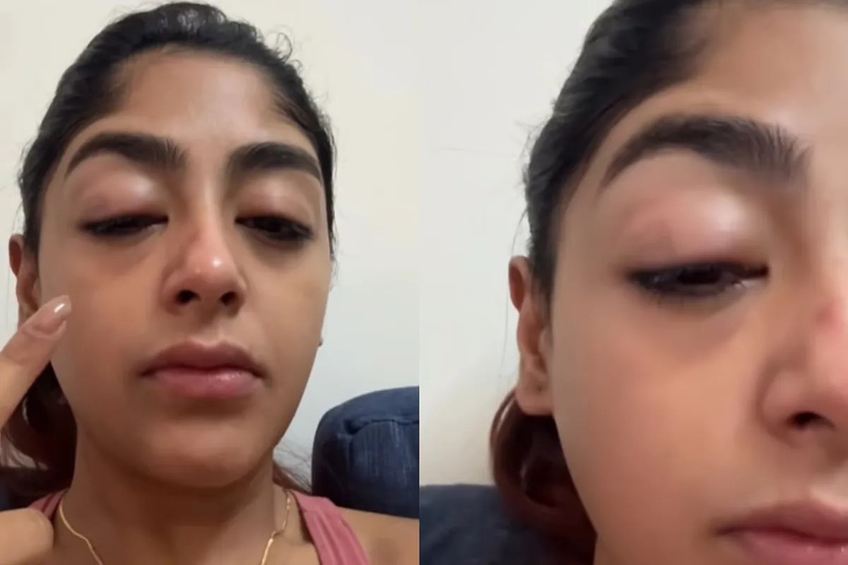 सूजी आंखें, टूटे दांत, अभिनेत्री के साथ मुंबई के क्लब में हुई दरिंदगी, हमले के बाद प्रीत सिंह की हालत देख चौंके फैंस