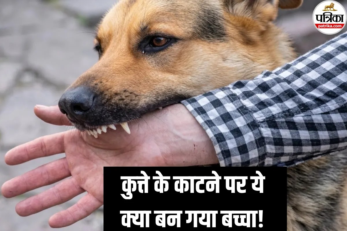 Rabies Symptoms: कुत्ते के काटने पर ये क्या बना बच्चा! डॉक्टर से जानें वायरल वीडियो का सच