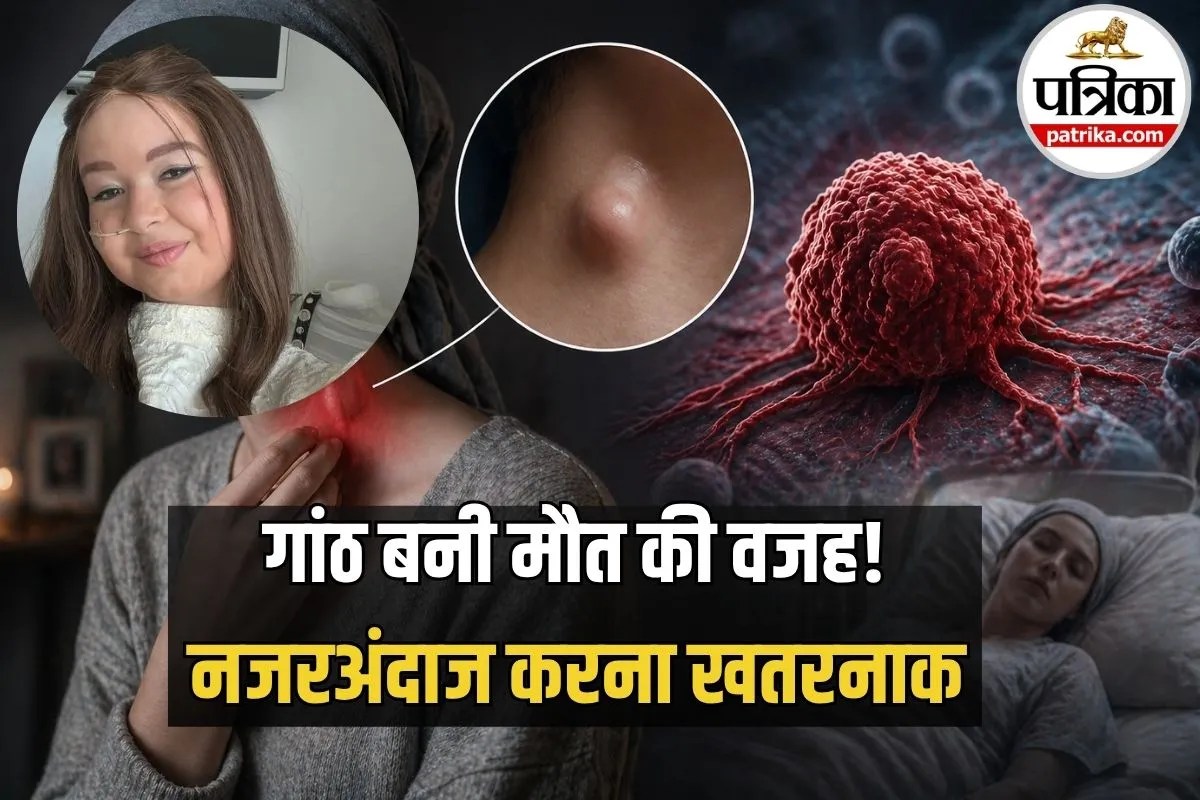 शरीर की छोटी सी गांठ बनी जानलेवा, 19 साल की इन्फ्लुएंसर की मौत, जानिए इस Rare Cancer के 3 संकेत