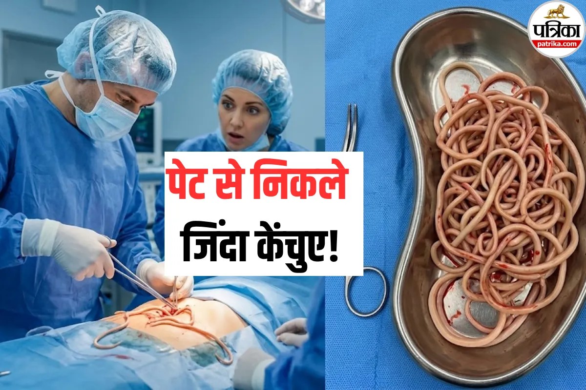 Stomach Worms: पेट से निकले जिंदा केंचुए! सर्जरी कर बचाई जान, डॉक्टर से जानें क्या है Ascariasis