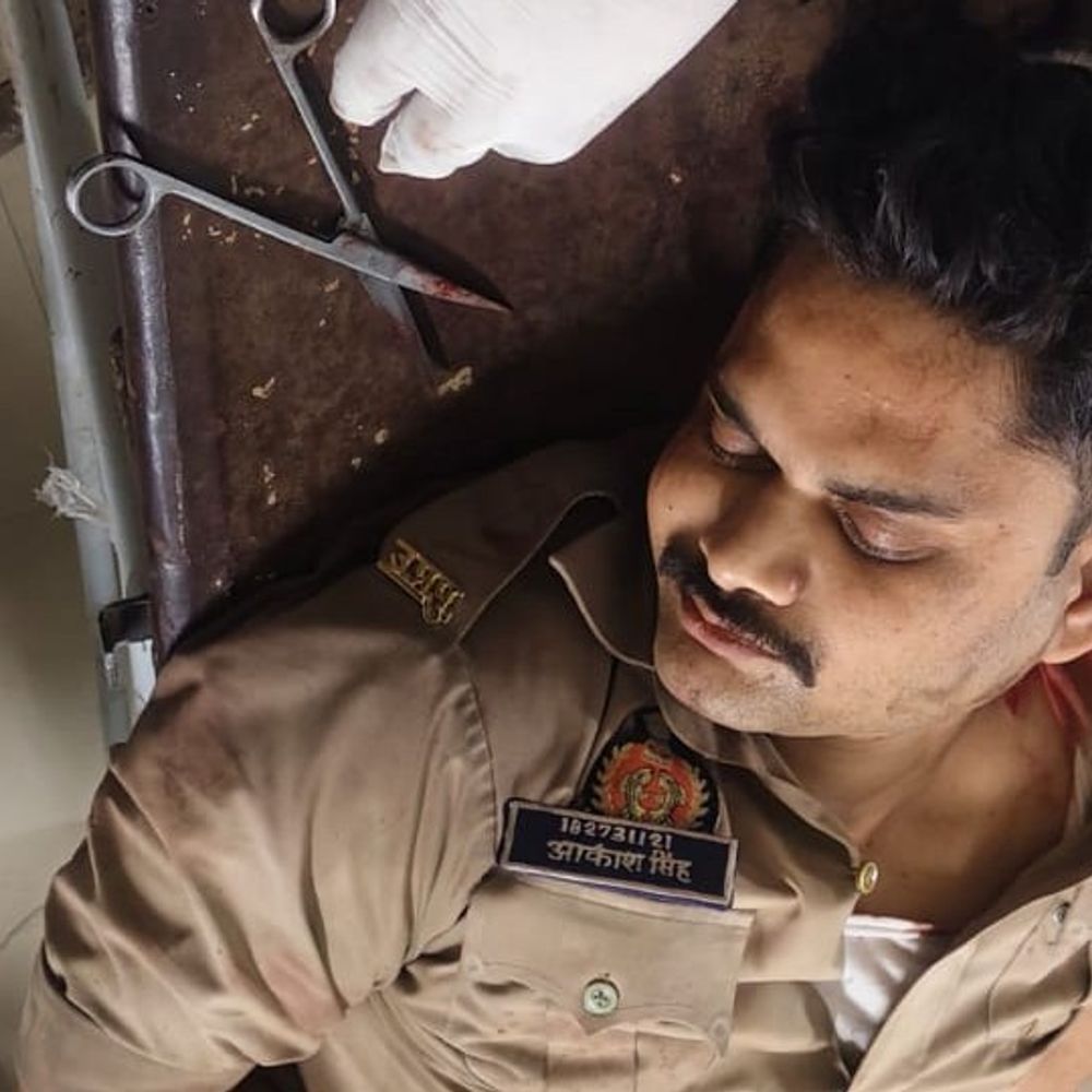 अपराधी का पीछा करने में GRP सिपाही का पैर कटा:गोंडा में हिरासत से भाग रहा था, पकड़ने के प्रयास में ट्रेन की चपेट में आया