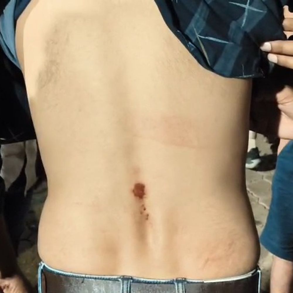 शिवपुरी में छात्र से मारपीट, 440 रुपए छीने:पार्षद ने पुलिस पर लगाया बदमाशों से दलाली कराने का आरोप, थाने पर दिया धरना