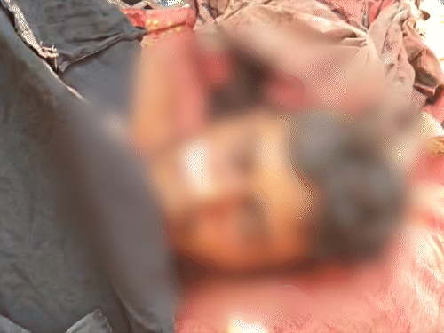 भागलपुर में किसान के सिर में गोली लगने से मौत:परवल की फसल तोड़ने गया था, आत्महत्या करने की आशंका