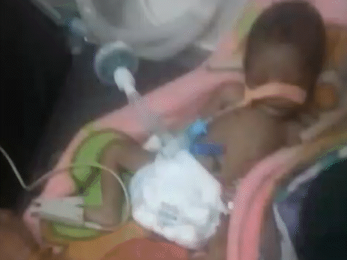 AIIMS-PMCH में बेड नहीं मिला, नवजात की मौत:3 दिन के बच्चे को लेकर लखीसराय से पहुंचे थे परिजन, प्राइवेट हॉस्पिटल में 51 हजार का बिल बना