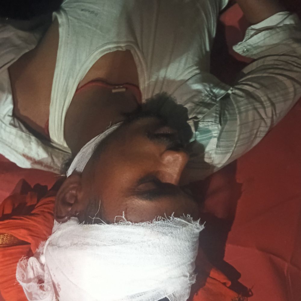 गिद्धौर में बाइक सवार अनियंत्रित होकर गिरे:2 युवक गंभीर घायल, गंगरा गांधी आश्रम के पास हादसा