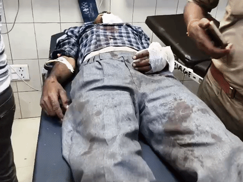 रंजिश में पूर्व प्रधान के बेटों ने मारी गोली:अलीगढ़ के अंडला में देर रात युवक पर किया हमला, जेएन मेडिकल कॉलेज में भर्ती